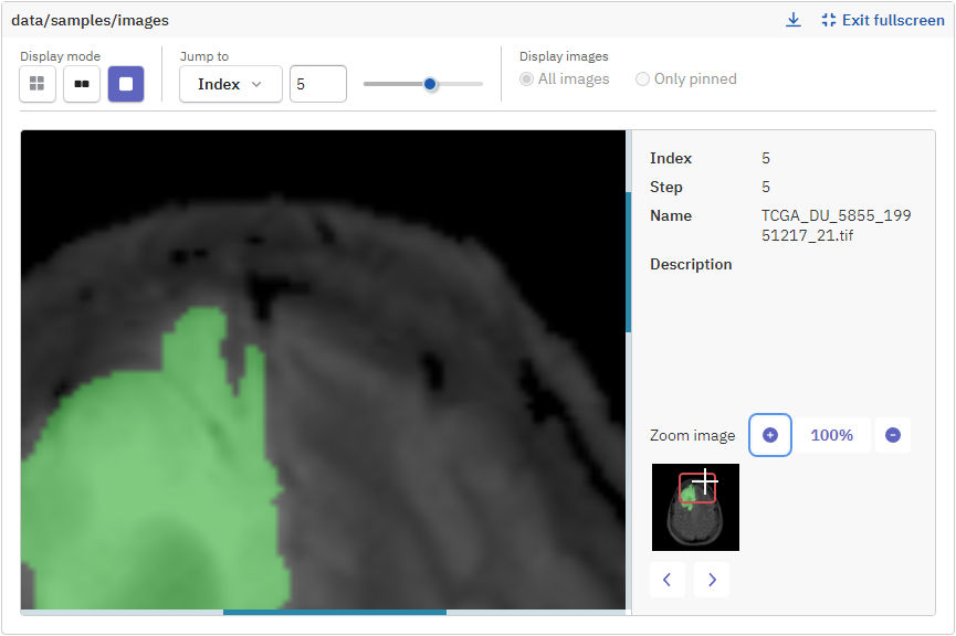 Repositioning zoomed-in area in image gallery